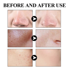 West Month Blackhead Mud Mask Oil Control Pore Tightening Skin