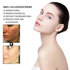 West Month Blackhead Mud Mask Oil Control Pore Tightening Skin