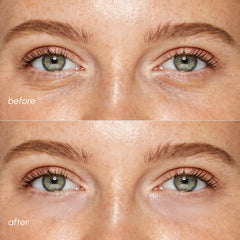 Pink Eye Patches for Puffy Eyes